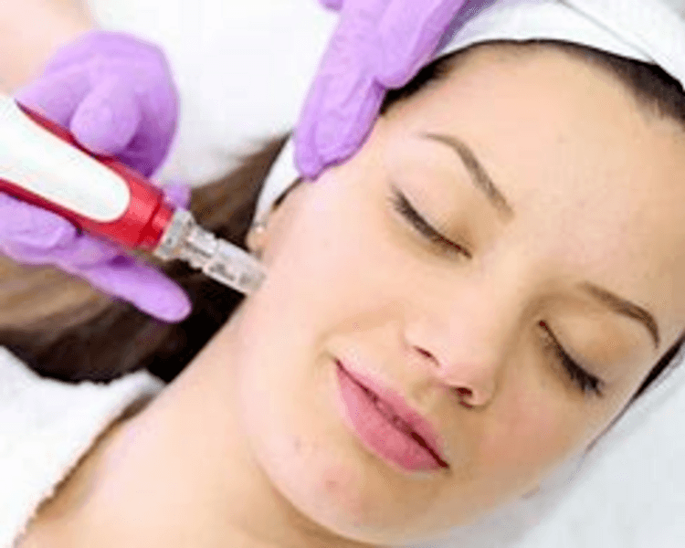 Dermapen Rejuvenecimiento