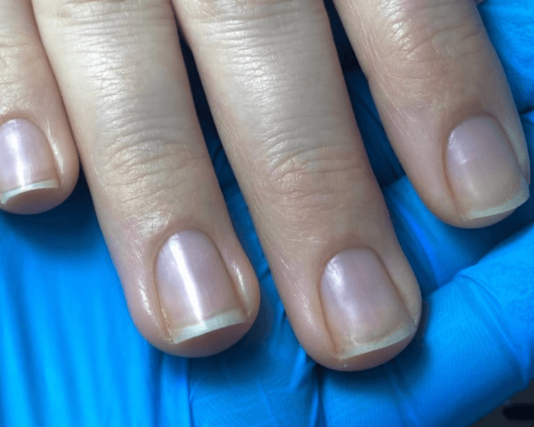 RETIRO DE SERVICIO (UNICO SERVICIO A REALIZAR)