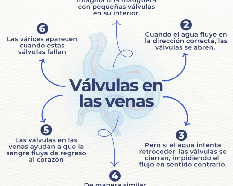 Consulta Várices Primera Vez
