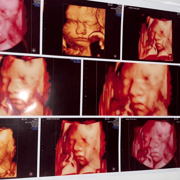 PAUL CRESPO (GINECOLOGIA) photo