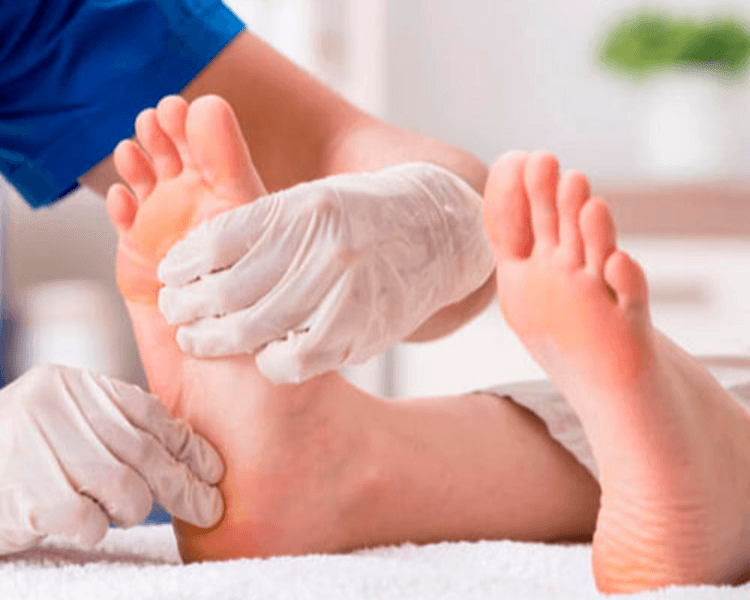 Tratamiento de Verruga Plantar