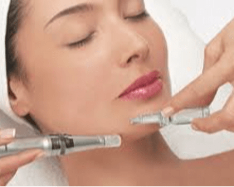 Microneedling (dermapen, microagujas)