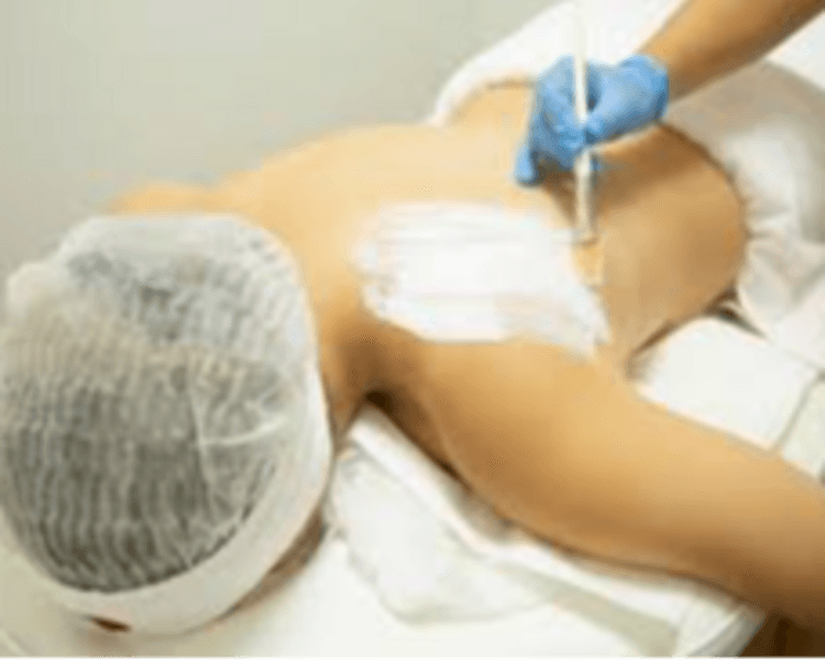 Limpieza Espalda (zona superior)