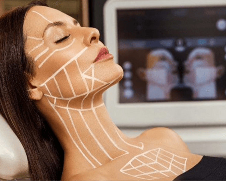 Evaluación HIFU Mfus Facial