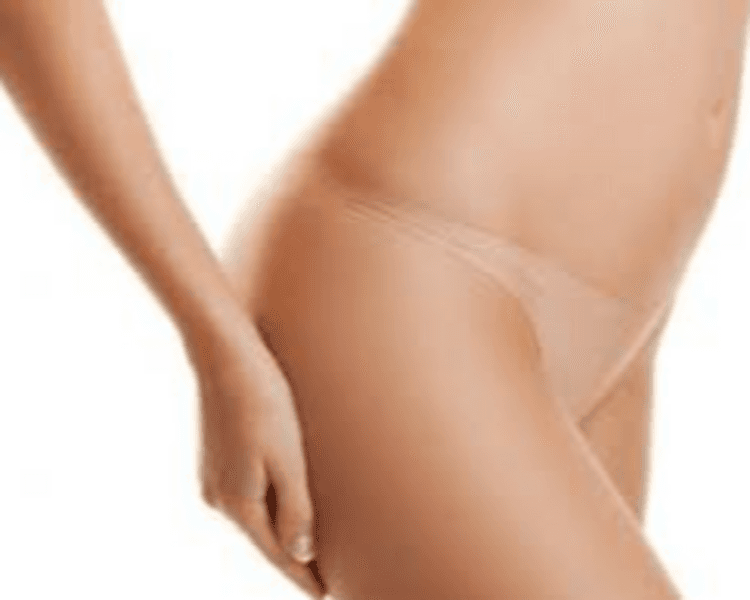 DEPILACION LASER MUJER : CAVADO COMPLETO