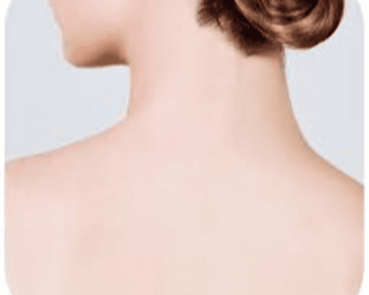 DEPILACION LASER MUJER : NUCA