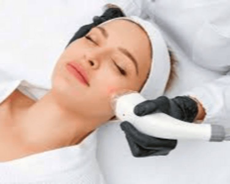 DEPILACION LASER MUJER : ROSTRO
