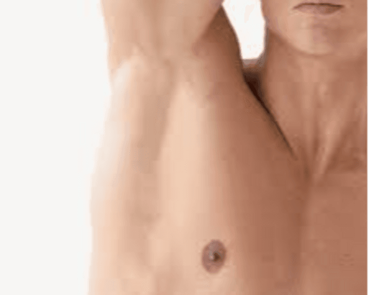 DEPILACION LASER HOMBRE: AXILAS