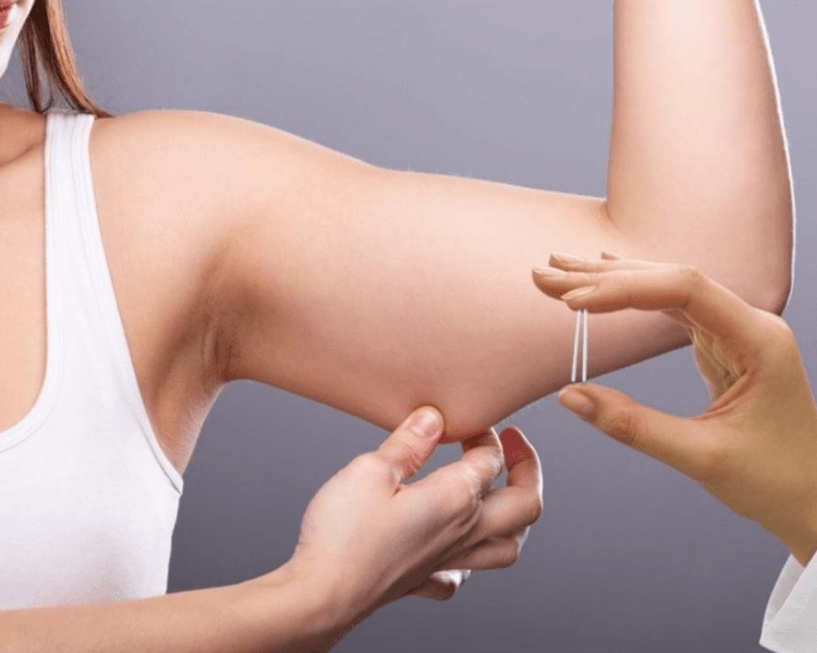 Inserción implanon/Jadelle