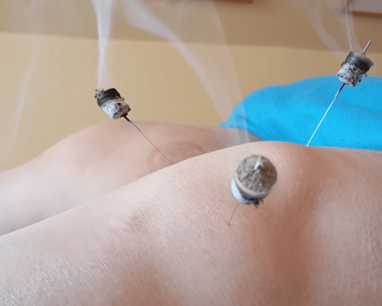 Primera sesión evaluación + atención