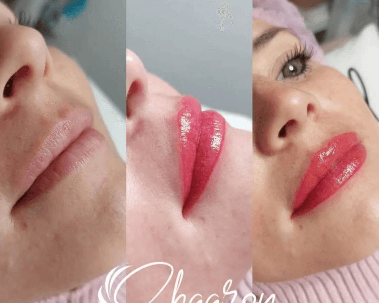 MICROPIGMENTACION DE LABIOS