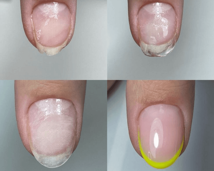 Arreglo/ alargue por uña