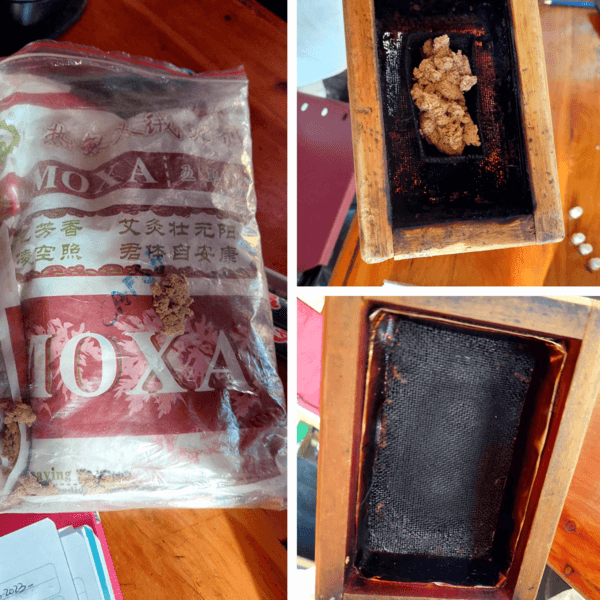 Moxibustion para tonificar