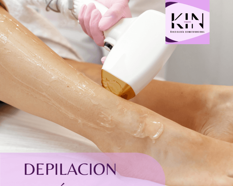 DEPILACIÓN LÁSER 6 SESIONES