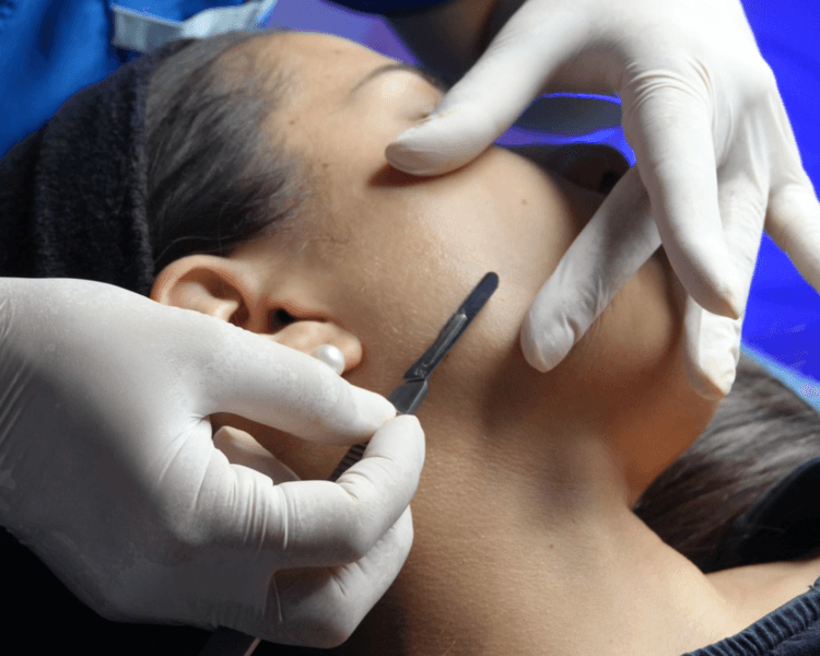 Higiene Facial c/ Dermaplaning - 1 sesión