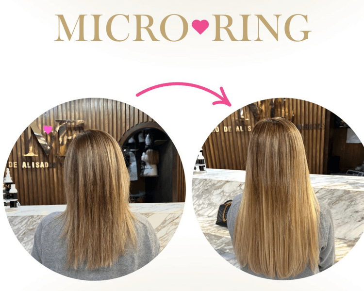 Aplicación de Micro Ring 1x1 (1 paquete)