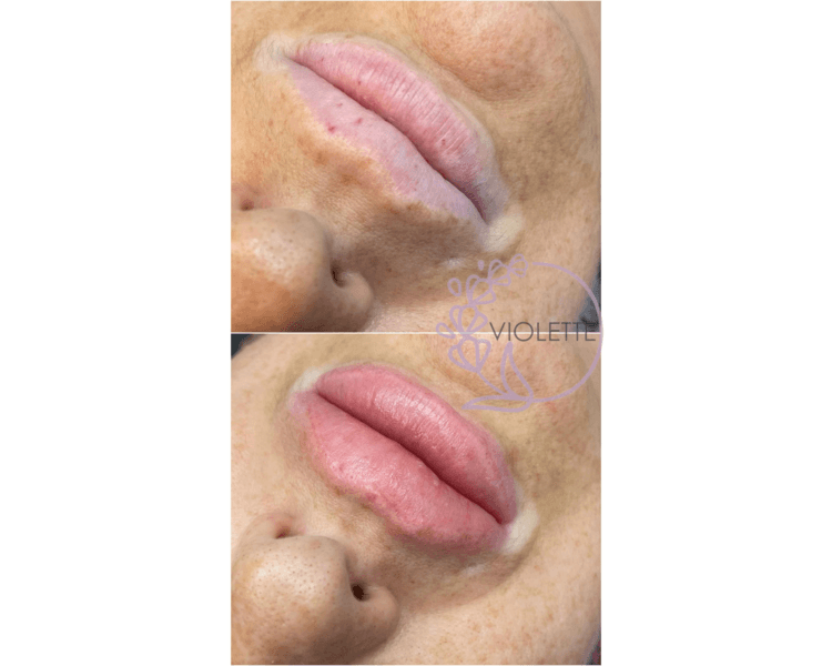 Micropigmentacion en Labios- 1sesion