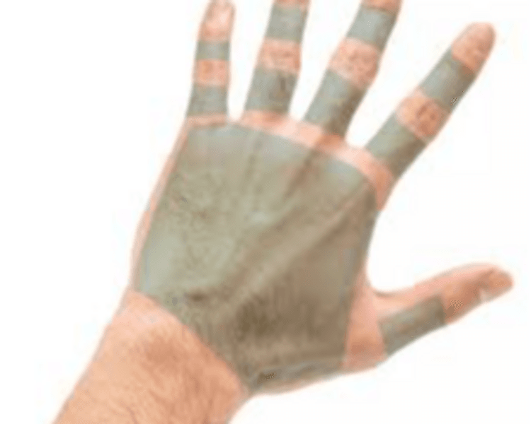 DEPILACION LASER HOMBRE: MANOS