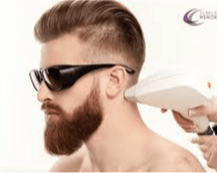 DEPILACION LASER HOMBRE: NUCA