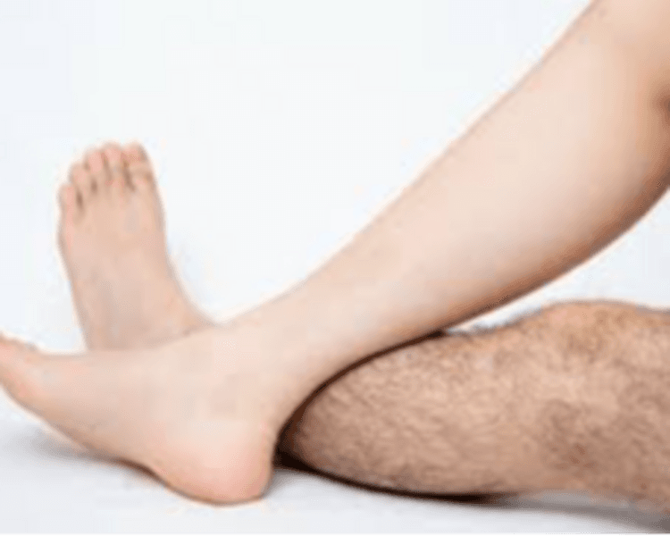 DEPILACION LASER HOMBRE: MEDIA PIERNA