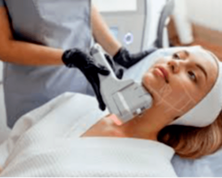 HIFU 14D PRO MAX FACIAL : zona ROSTRO