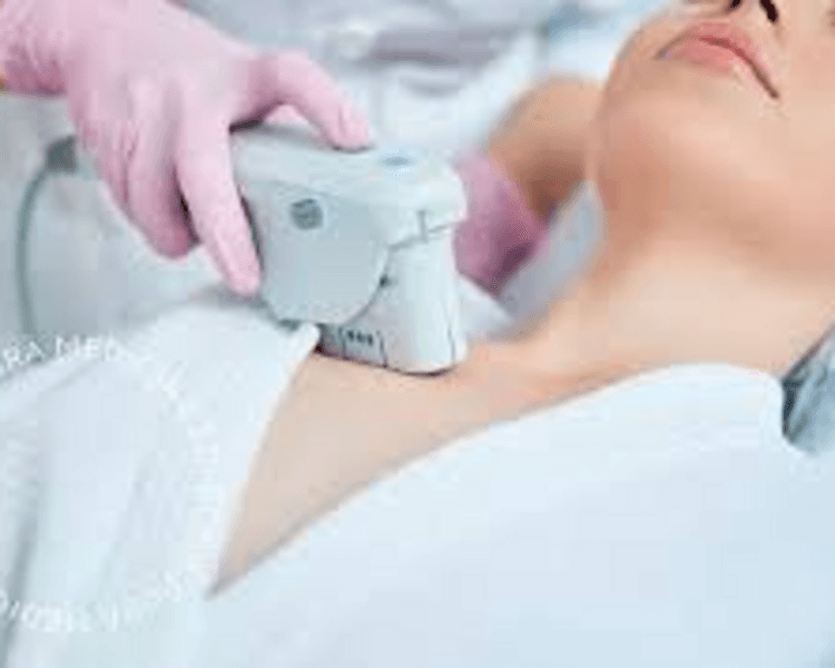 HIFU 14D PRO MAX CON LIPOSONIC : zona ESCOTE