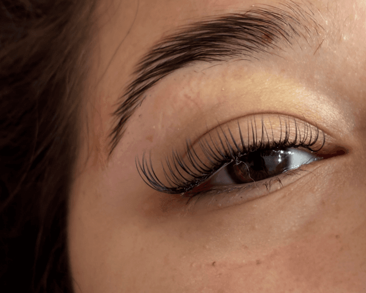 Extensiones Clásicas