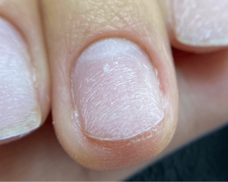 Primera sesión de reconstrucción