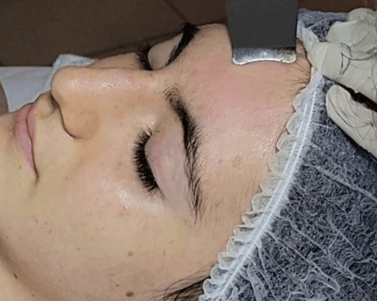 LIMPIEZA FACIAL PROFUNDA