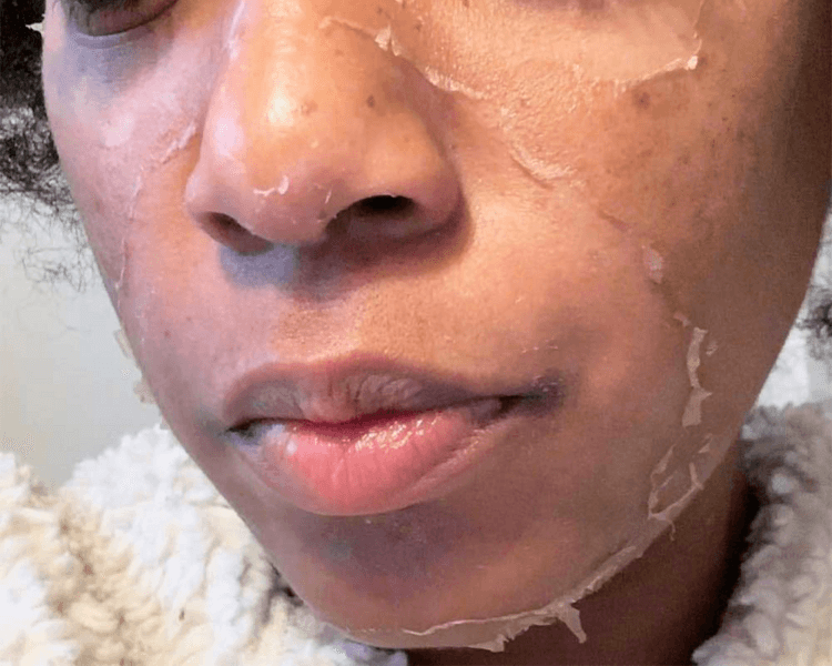 PEELING FACIAL