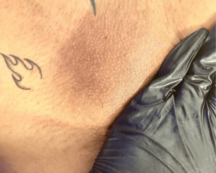 DEPILACION ZONA INTIMA MUJER BRASILEÑO