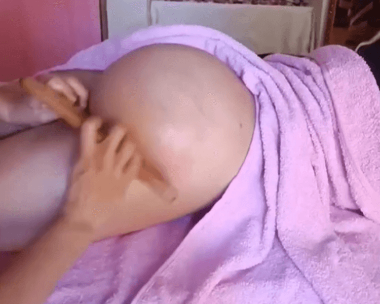 LEVANTAMIENTO DE GLUTEO