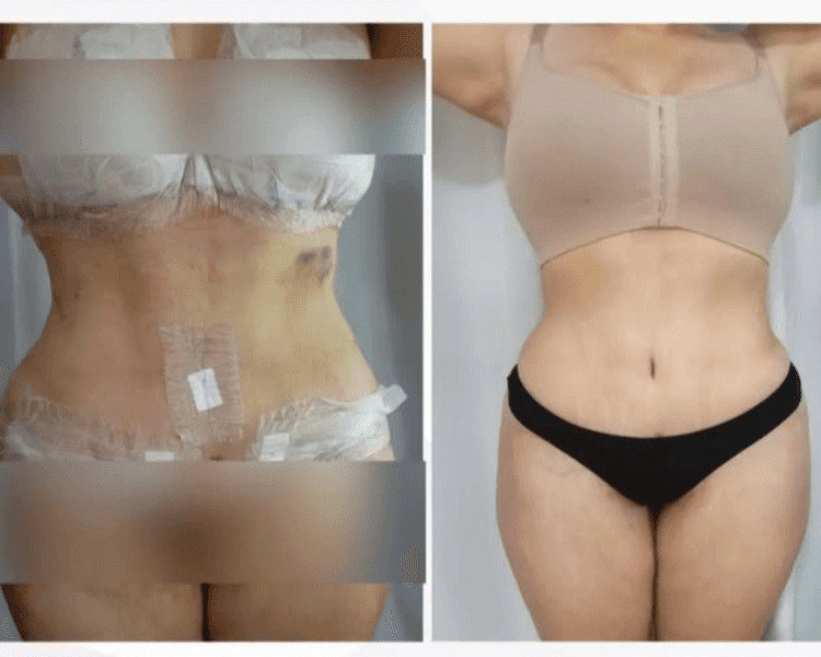 POST OPERATORIO PQ 5