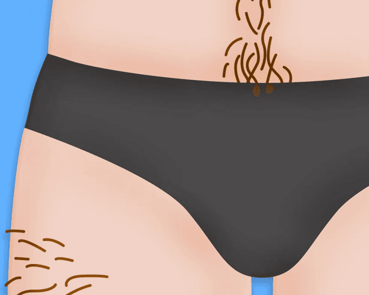 DEPILACION MANZILIAN