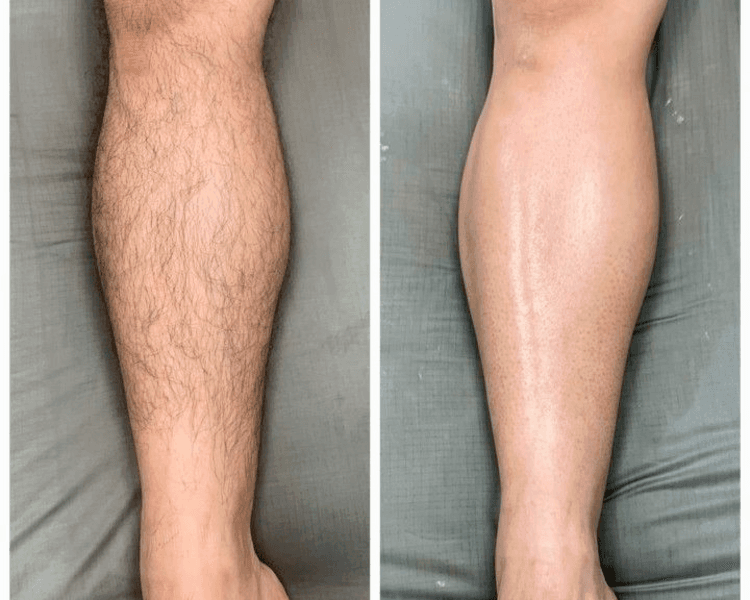 Cavado + Tira de cola + Pierna Entera (HOMBRE)