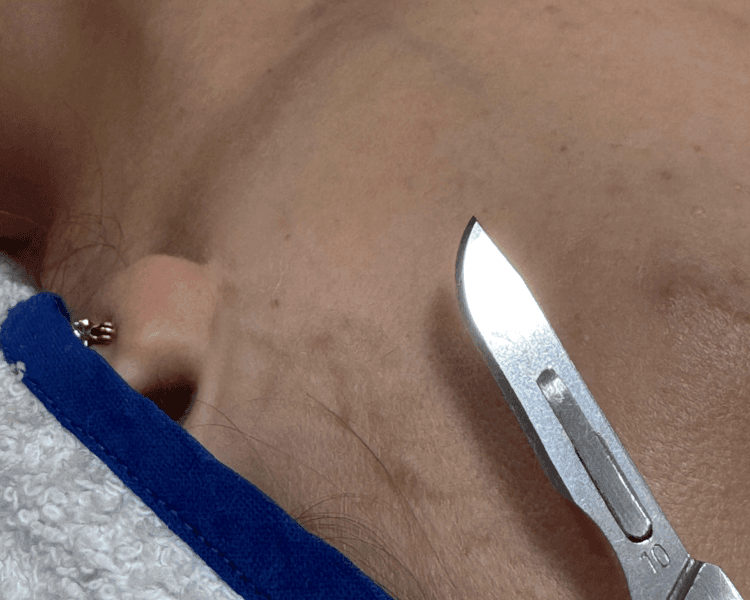 Limpieza glow con dermaplaning