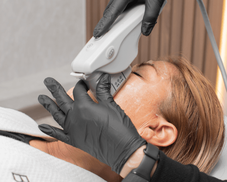 Hifu Facial