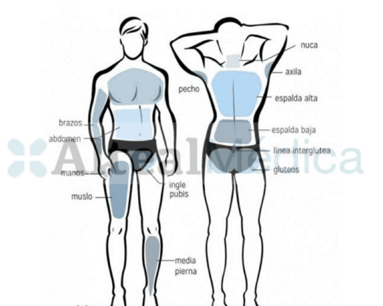 ZONA PERIANAL (1 sesión) Depilación Láser Diodo