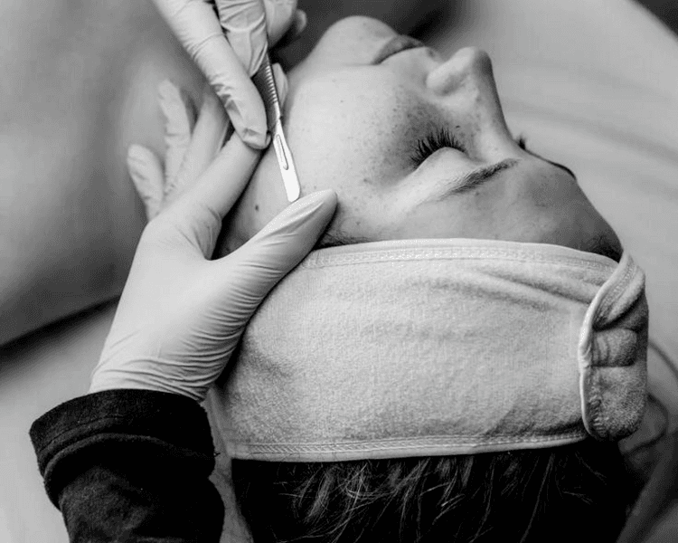 Limpieza facial profunda + Dermaplaning (personalizado)