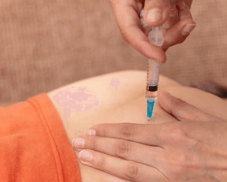 Inyección intramuscular sin insumos