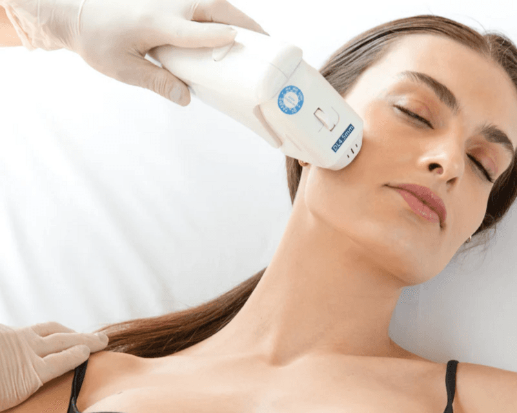 HIFU PAPADA Y CUELLO