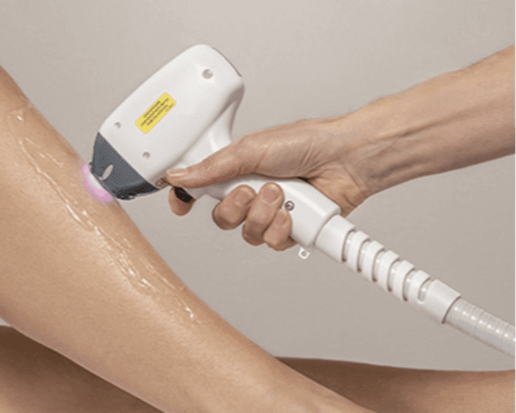 Laser Media Pierna y Bikini