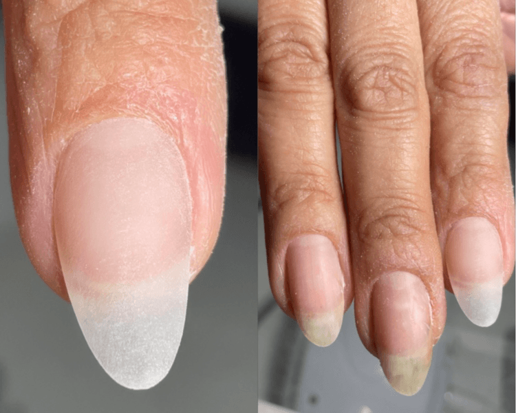 Extensión en 1 uña