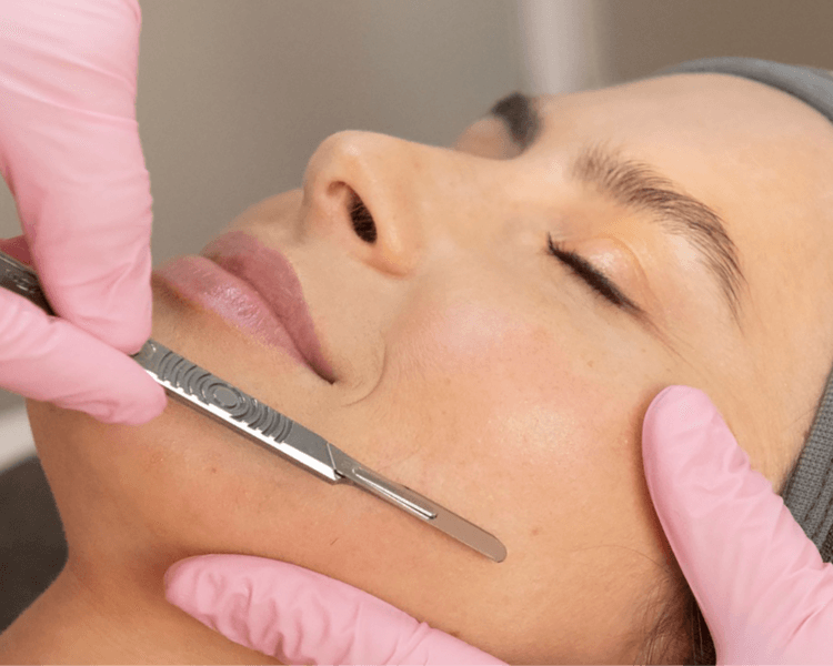 Dermaplaning