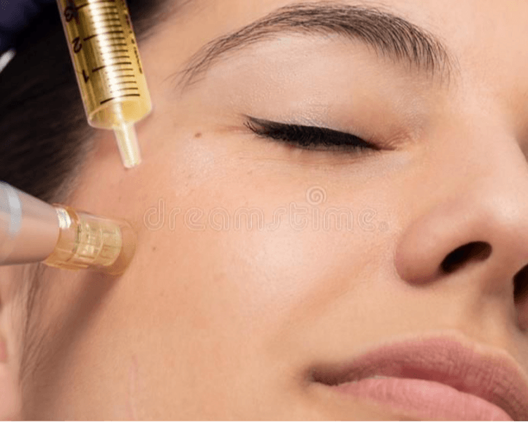 inducción de vitaminas con dermapen