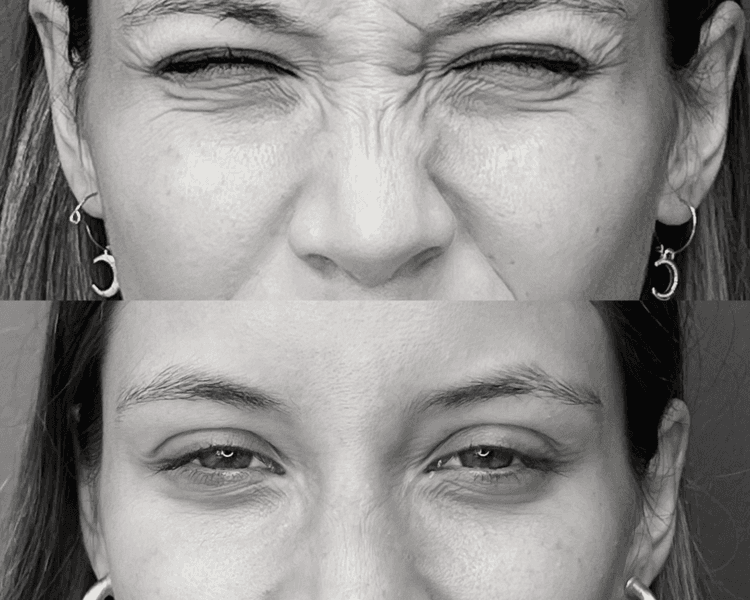 🟢Abono paciente antiguo🟢