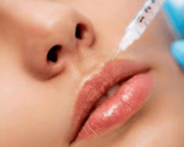 ACIDO HIALURONICO -DESDE