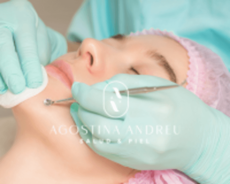 LIMPIEZA FACIAL PROFUNDA