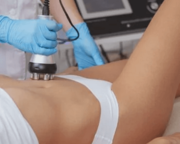 MOLDEO ABDOMINAL - 1 Sesión