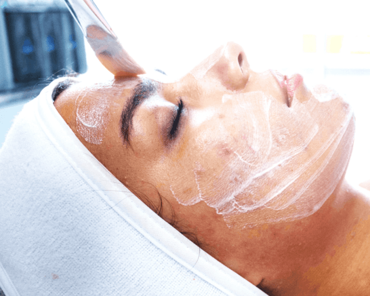 Tratamiento anti acne